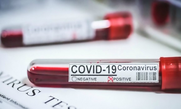 Covid-19: Bilan de ce samedi marqué par la stabilité