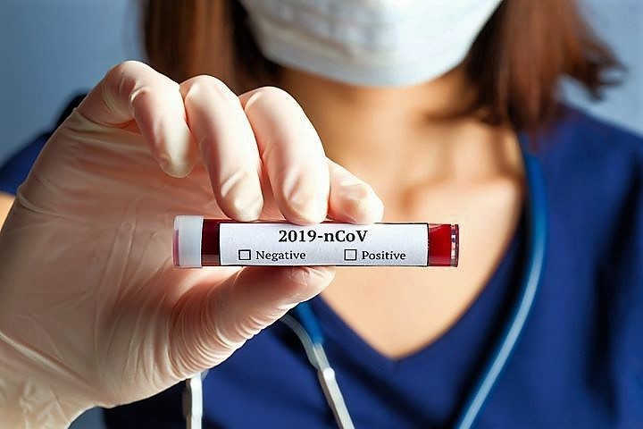 Covid-19: 601 nouveaux cas, 314 guérisons et 11 décès.