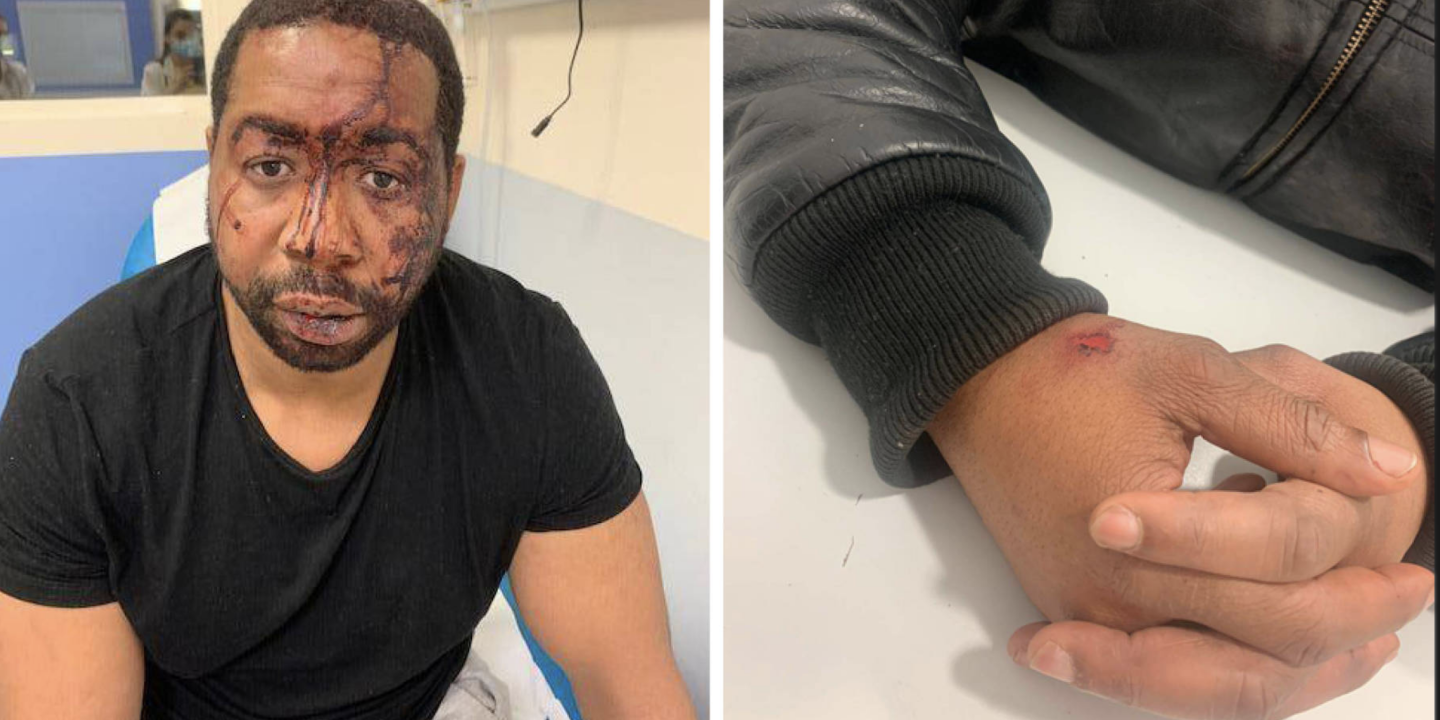 Affaire du producteur tabassé en France : les trois policiers mis en détention provisoire