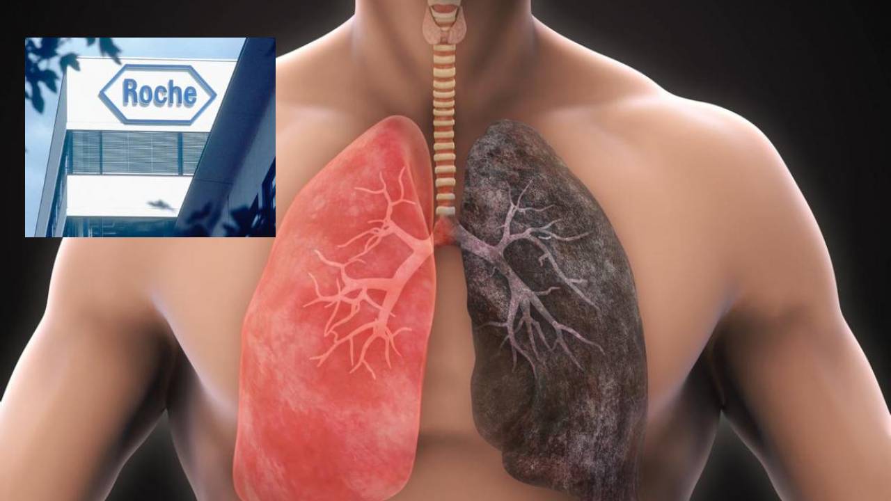 بمناسبة شهره العالمي: مخابر روش الجزائر تُحسّس من مخاطر سرطان الرئة