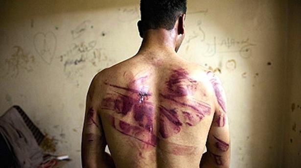 Un comité contre la torture voit le jour: Il réclame une enquête sur les sévices infligés à Walid Nekkiche